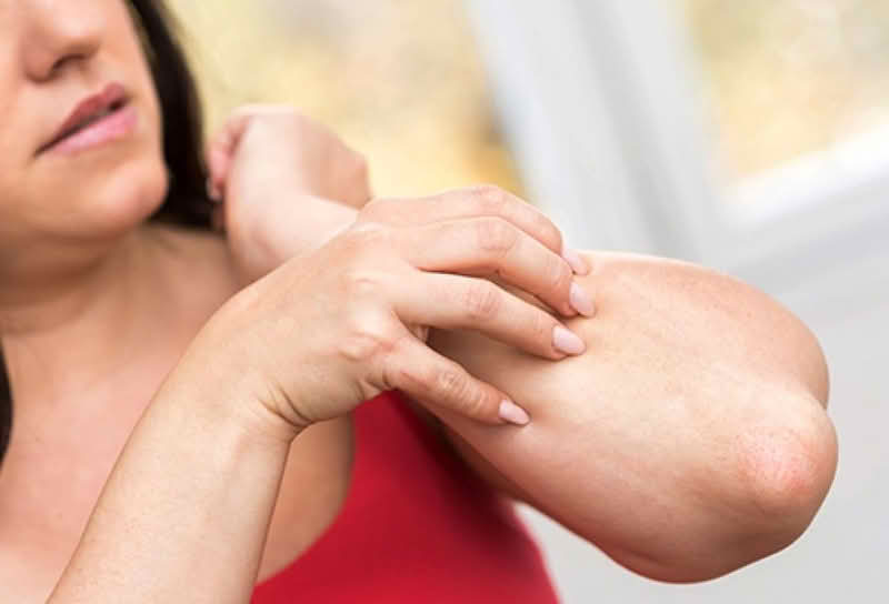 Zdravlje / Svrbi vas koža nakon tuširanja? Ovo su mogući uzroci i kako ih spriječiti